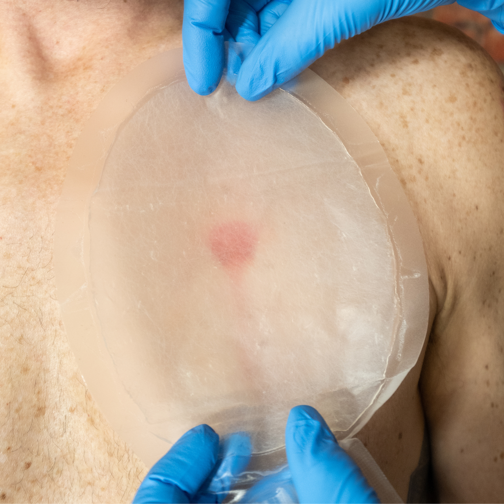 HALO CHEST SEAL (2PK) - Default Title Medical Components Refuge Medical